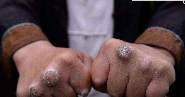 明星繭，小巷深處的隱秘瑰寶