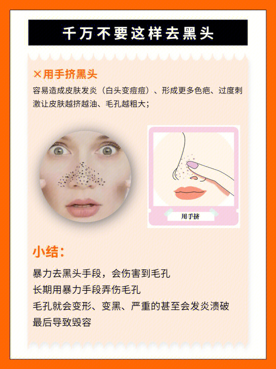 擠黑頭最新方法與注意事項(xiàng)詳解